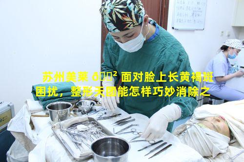 苏州美莱 🌲 面对脸上长黄褐斑困扰，整形天团能怎样巧妙消除之